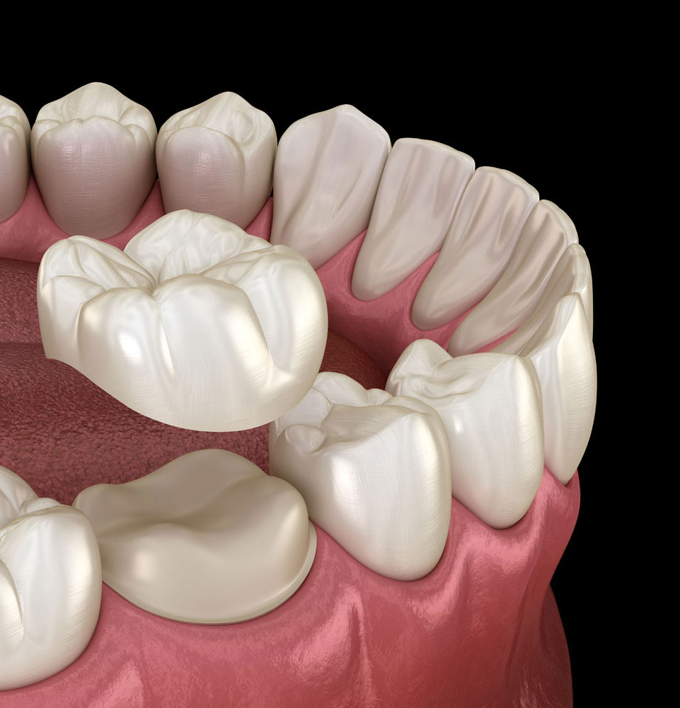 crown 3d model