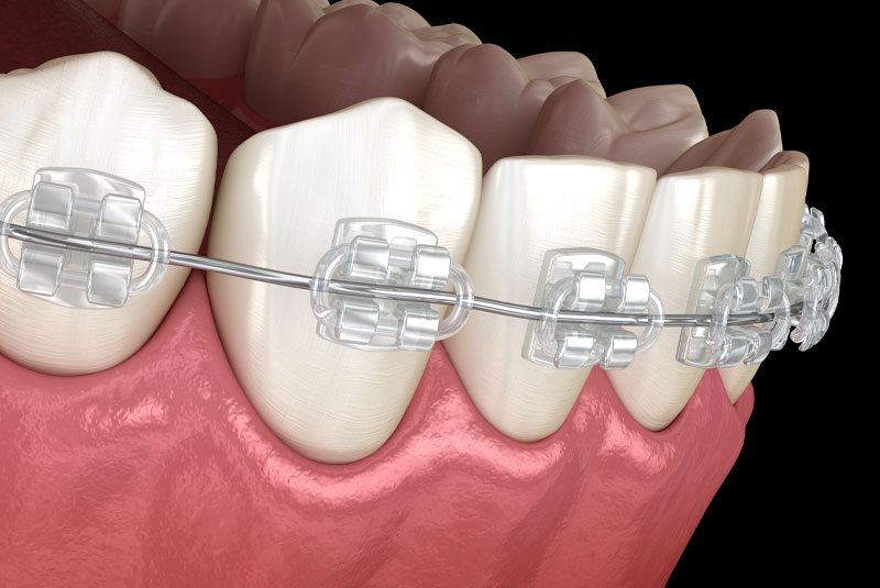 orthodontics tmj treatment